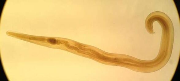 Παράσιτο των εντέρων