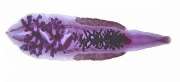 Σιβηρική σύμπτωση